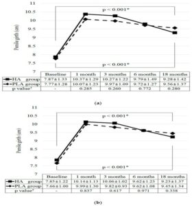 LaMedecine Esthetique Genitale chez l'Homme la pénoplastie médicale par injection d'acide hyaluronique Clinique Rivoli Massena 1