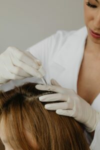le PRP cheveux dans le traitement de la pelade et du psoriasis du cuir chevelu Clinique Rivoli Massena 3