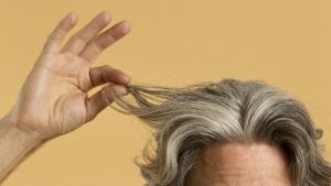 les signes d'une greffe de cheveux réussie en Medecine Esthetique Clinique Rivoli Massena 2