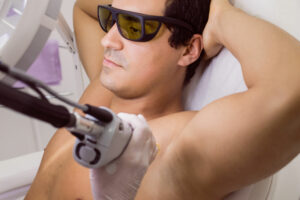 Epilation laser pour hommes à Strasbourg - Clinique Rivoli Massena